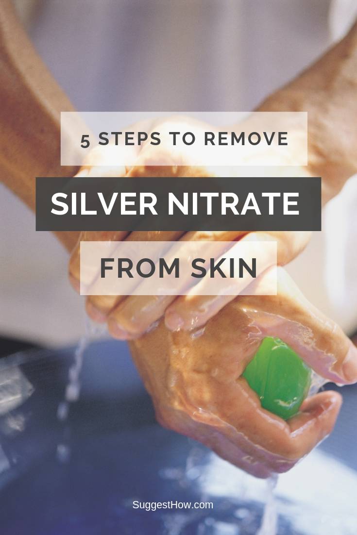 5 Steps to Remove Silver Nitrate From Skin